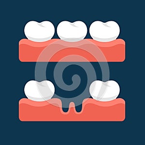 Teeth with Gum for Healthcare. Vector