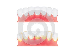 Teeth and gums