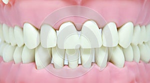 Teeth and gums on dentist model, oral and dental hygiene