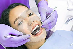 Teeth health concept. Cropped photo of smiling woman mouth under treatment at dental clinic