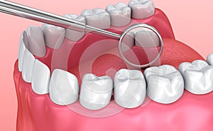 Teeth inspection with mirror. Medically accurate tooth