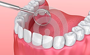 Teeth inspection with mirror. Medically accurate tooth illustration