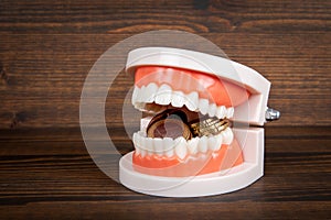 Teeth model and money on a wood texture background. Health and wellness