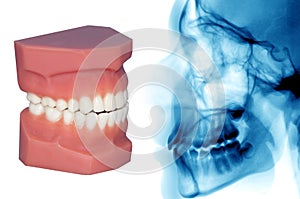 Teeth model and x-ray isolated on withe