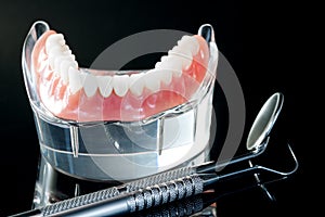 Teeth model showing an implant crown bridge model.