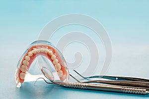 Teeth model showing an implant crown bridge model.