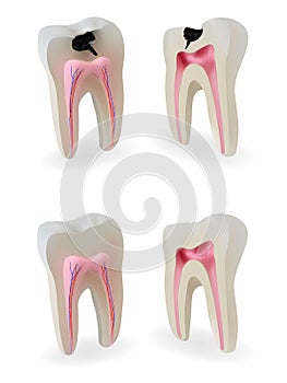 Teeth models photo