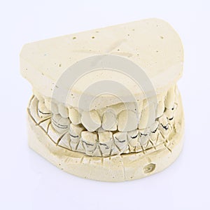 Teeth mold