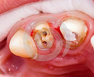Teeth rehabilitation