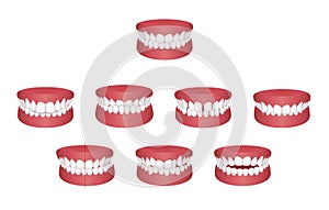 Teeth trouble  bite type  vector illustration set photo