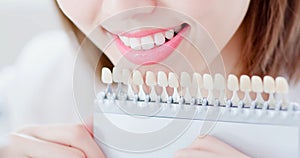 Teeth whiten concept