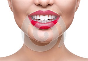 Teeth whitening. Healthy white smile closeup