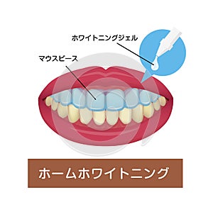 Teeth whitening at home vector illustration Japnaese