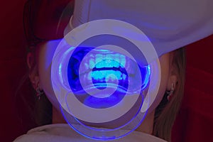 Teeth whitening procedure ultraviolet lamp whiten teeth girl photo