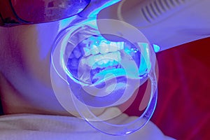 Teeth whitening procedure ultraviolet lamp whiten teeth girl photo