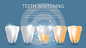 Teeth whitening vector medical poster banner template