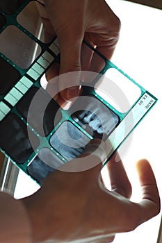 Teeth x-ray exploring