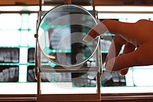 Teeth x-ray on light table under magnifier