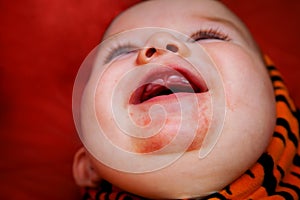 Teething Baby With Drool Rash