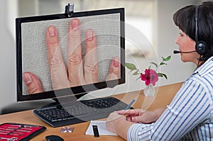 Telemedicine dermatologist looking fingernails