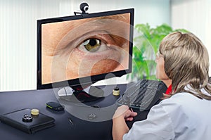 Telemedicine eye doctor observes eyelid cyst on computer photo