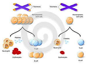 Telomere and Aplastic anemia