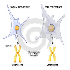 Telomeres  of Chromosome in Normal fibroblast and Cell senescence photo