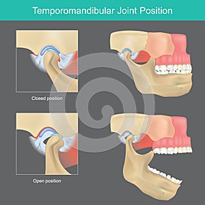 Temporomandibular joint position.