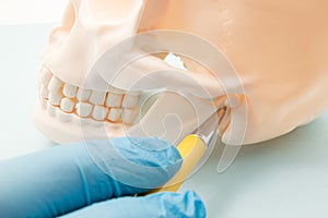 Temporomandibular joint TMJ, joint of the lower jaw and the ear canal. The physician indicates on the mandibular joint or human