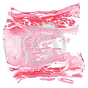 Tendon, a piece of sinew section, HE stain, 20X light micrograph