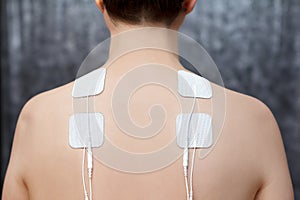 TENS fibromyalgia treatment electrodes patient shoulders