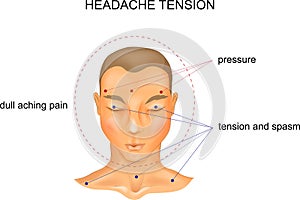 Tension headache symptoms