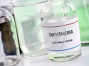 Test diphtheria in laboratory, conceptual image photo