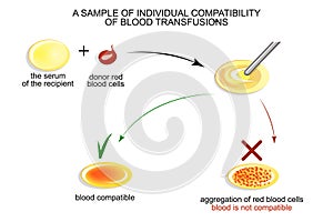 The test on individual blood compatibility photo