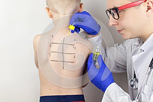 An allergist in the laboratory conducts an allergy prick-test. Skin test for household, food, epidermal allergic reactions. The photo