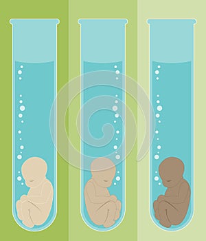 Test Tube Babies