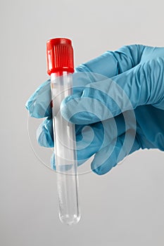 A test tube for blood analysis is in the hand of experimenter