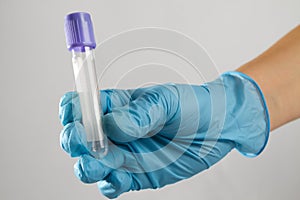 A test tube for blood analysis is in the hand of expert