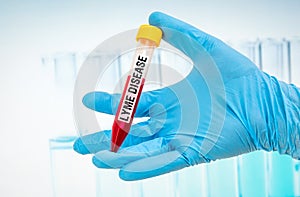 Test-tube with blood sample for LYME DISEASE test