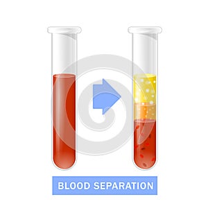 Test tube with blood after separation of platelets, PRP, platelet-rich plasma