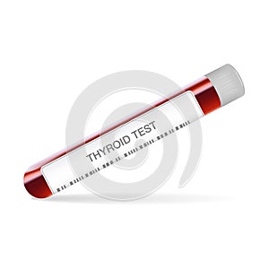 Test Tube With Blood For Thyroid Test. Endocrinology System Or Hormone Secretion. Vector Illustration.