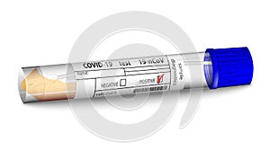 Test Tube with Coronavirus 2019-nCoV swab Sample. Positive blood test result for Covid 19 virus, originating in Wuhan, China.