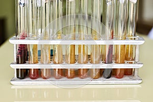 Test tube in holder with Kligler agar medium suspected to salmonella and e coli