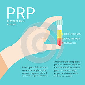 Test tube with PRP