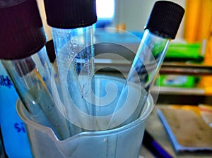 Test Tube Before The Sterilization Process