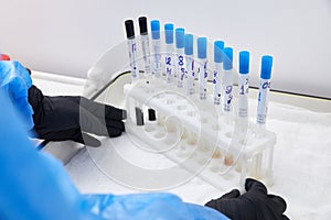 Test tubes rack with madical samples on the table at the modern laboratory