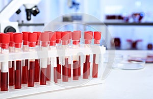 Test tubes with blood samples for analysis on table in laboratory