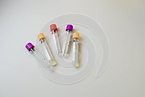 Test tubes with blood samples on table in laboratory. Virus research