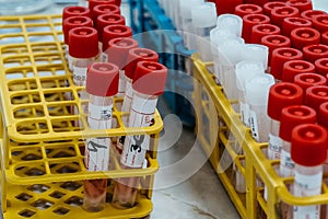 Test tubes with close-up pcr results in laboratory