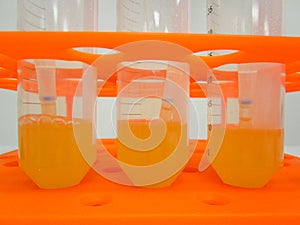 Test tubes with liquid media